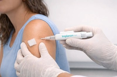 Saúde amplia oferta do Implanon na rede pública